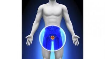 Prostatitis in men