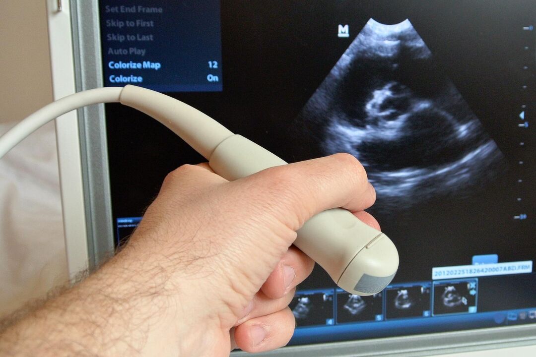 Ultrasound will help diagnose congestive prostatitis in men